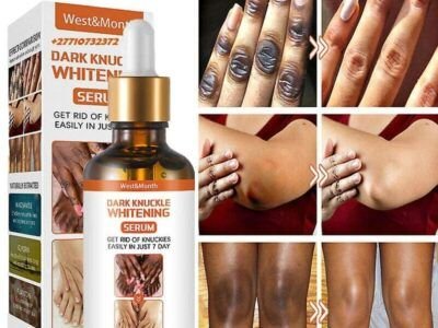 Dark Knuckle Whitening Serum In Mano Town in Sierra Leone, Elbow And Knee Brightening Serum In Roopville Town in Georgia Call ☏ +2771 073 2372 Get Rid Of Vitiligo In Vaasa City In Finland, Scars And Stretch Marks In Vereeniging City In South Africa