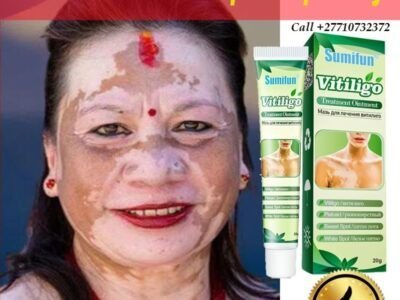 Dark Knuckle Whitening Serum In Mano Town in Sierra Leone, Elbow And Knee Brightening Serum In Roopville Town in Georgia Call ☏ +2771 073 2372 Get Rid Of Vitiligo In Vaasa City In Finland, Scars And Stretch Marks In Vereeniging City In South Africa