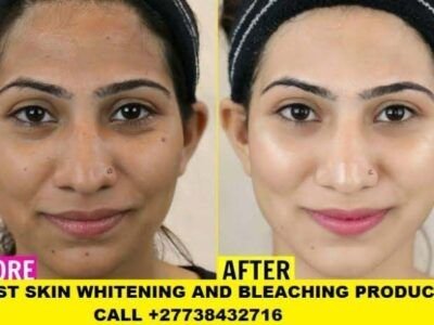 Permanent Skin Lightening Skin Whitening Products +27738432716