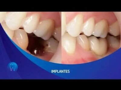 CLINICA DENTAL SMILE